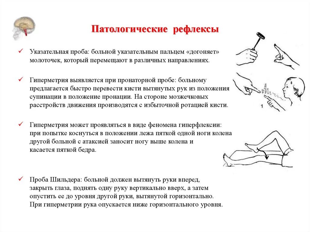 Как проверить рефлексы. Рефлекс Бабинского Оппенгейма Гордона. Патологические сгибательные и разгибательные рефлексы неврология. Рефлексы рук и ног неврология. Патологические рефлексы нижних конечностей в неврологии.