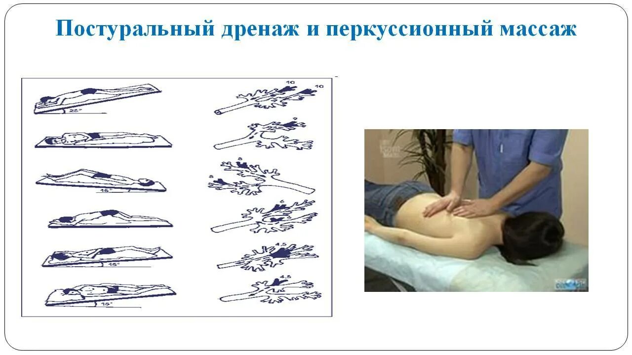 Постуральный дренаж бронхоэктатической болезни. Постуральный дренаж вибрационный массаж детям. Постуральный дренаж техника выполнения. Постуральный дренаж памятка для пациента. Постуральный массаж