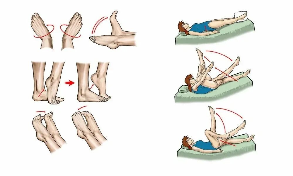 Гимнастику для кровообращения. Лечебная физкультура при парезе стопы. Лечебная гимнастика после флебэктомии. Лечебная физкультура после операции флебэктомии. ЛФК при парапарезе нижних конечностей.
