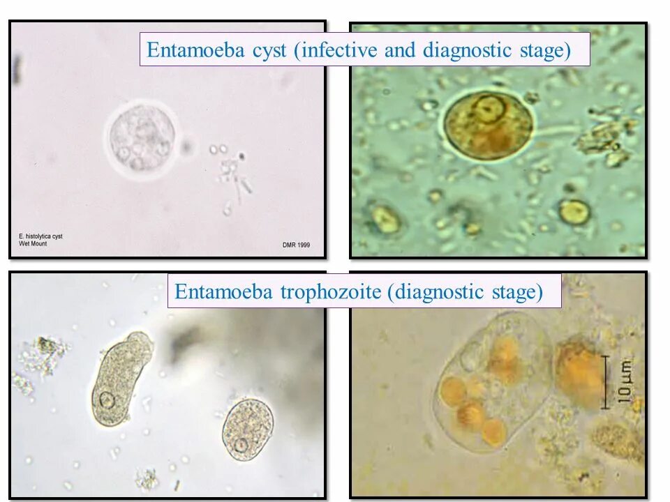 Entamoeba histolytica жизненный цикл. Entamoeba histolytica циста. Entamoeba histolytica микроскопия. Entamoeba histolytica диагностическая стадия. Entamoeba coli в кале