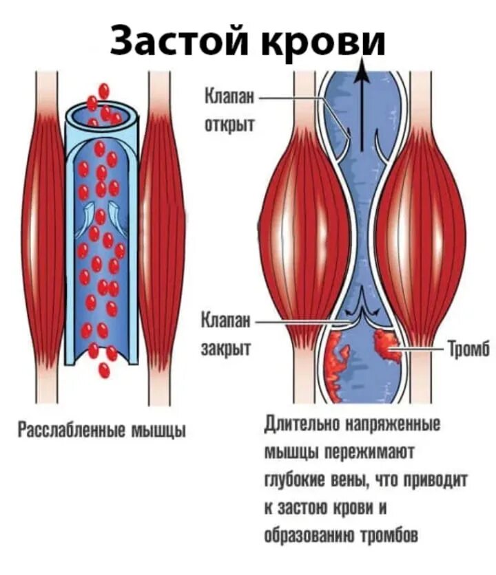 Застой крови у мужчин