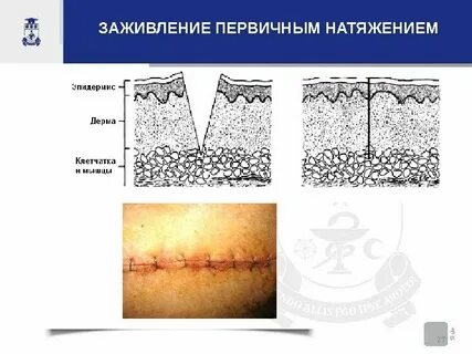 Сколько заживает ранка