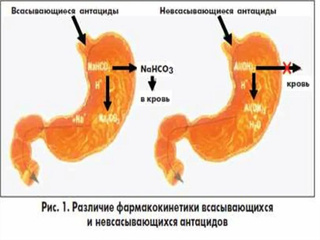 Механизм действия антацидов. Действие всасывающихся антацидов. Антациды механизм действия. Механизм действия антацидов схема. Антациды действие