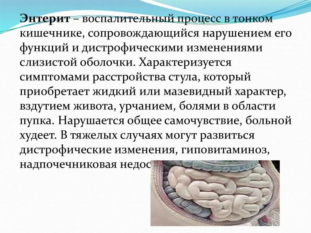 Какие заболевания являются кишечными
