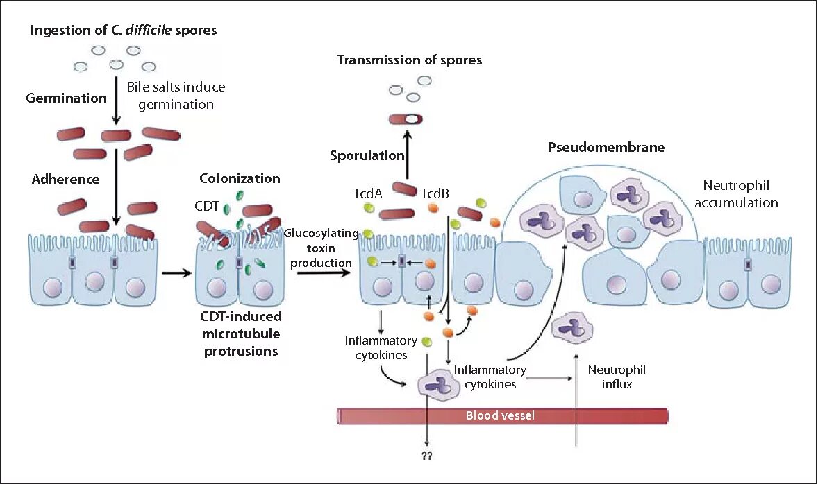 Клостридиум диффициле патогенез. Токсины а и в Clostridium difficile. Токсин клостридии диффициле. Clostridium difficile что это