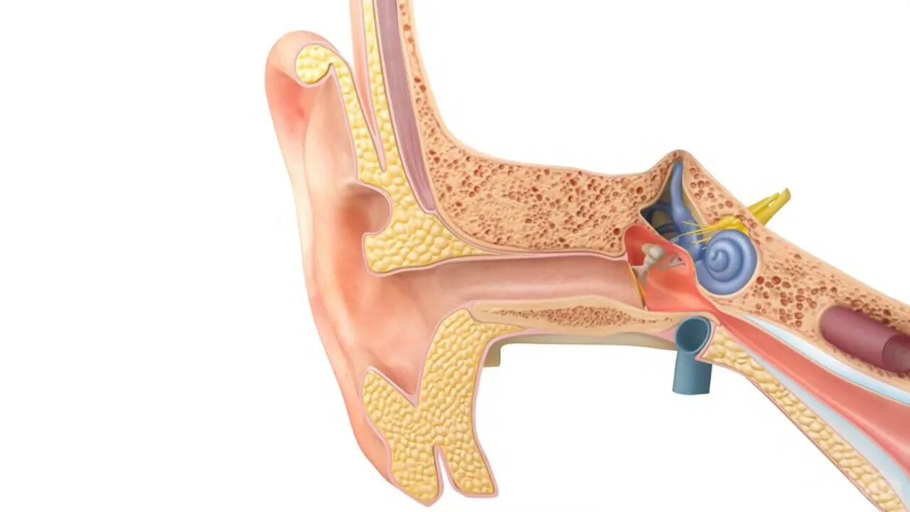Отосклероз уха операция