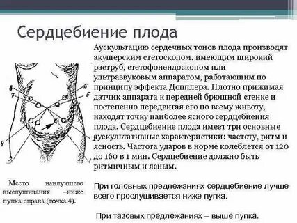 Выслушивание сердцебиения плода