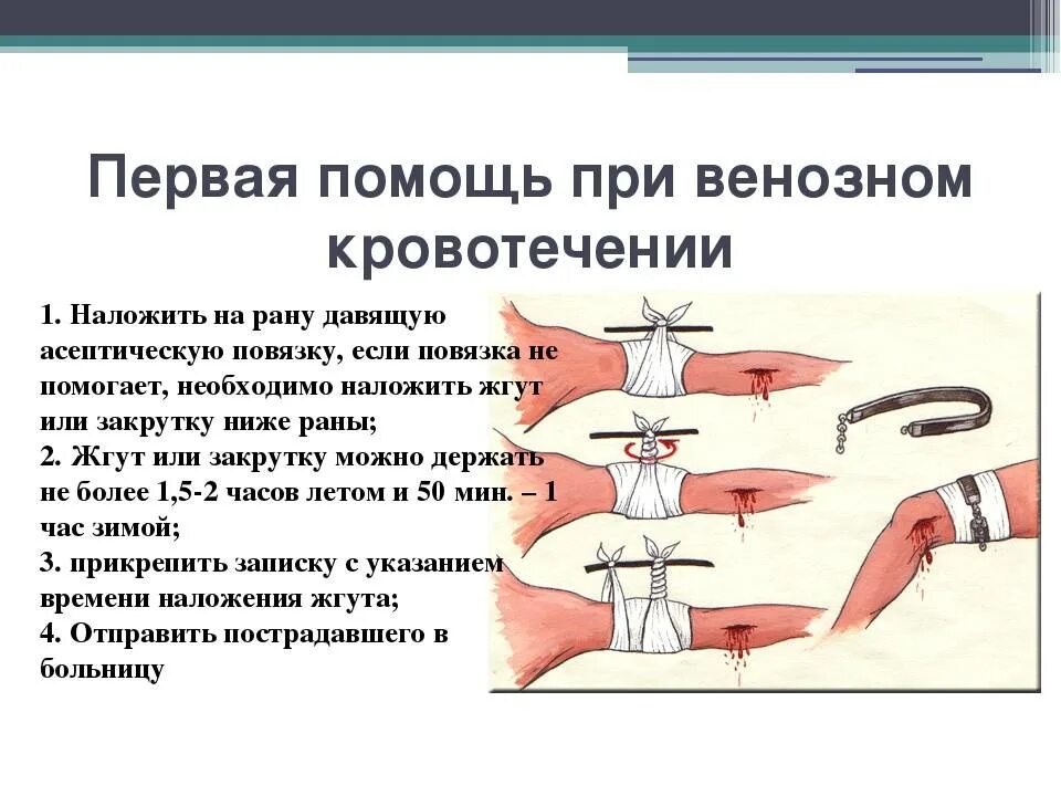 Оказание первой помощи при венозном кровотечении. Алгоритм оказания 1 помощи при венозном кровотечении. Оказание доврачебной помощи при венозном кровотечении. Оказание первой помощи при кровотечении из вены.