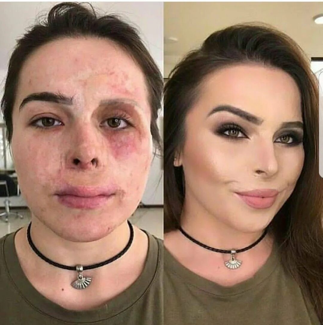 Макияж на проблемной коже до и после. Неудачный мейкап. Просила не портить ей мейкап. Девушки до и после макияжа. Просила не портить ей мейкап.
