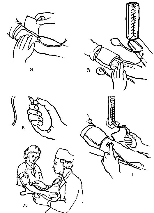 Измерение артериального давления манипуляция. Артериальное давление алгоритм измерения артериального давления. Измерение артериального давления алгоритм манипуляции. Алгоритм измерения артериального давления тонометром.