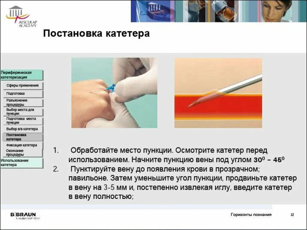 Алгоритм введения катетера. Методы введения лекарств. Струйное Введение препарата. Места постановки катетера. Введение в катетер лекарств средств.