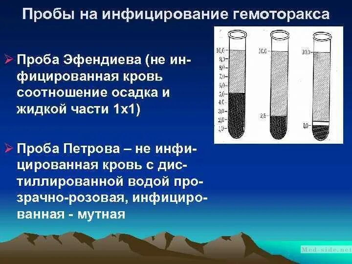 Проба Петрова. Проба Петрова и Эфендиева. Проба Петрова при гемотораксе. Проба Эфендиева при гемотораксе.