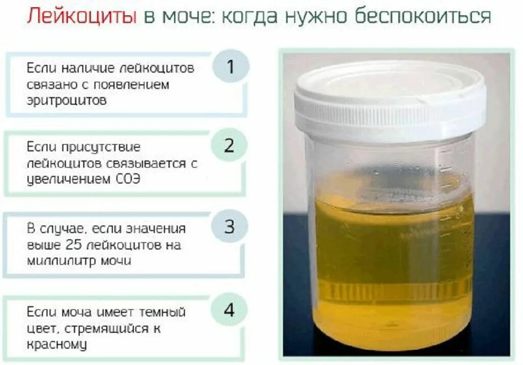 Моча прозрачная как вода причины