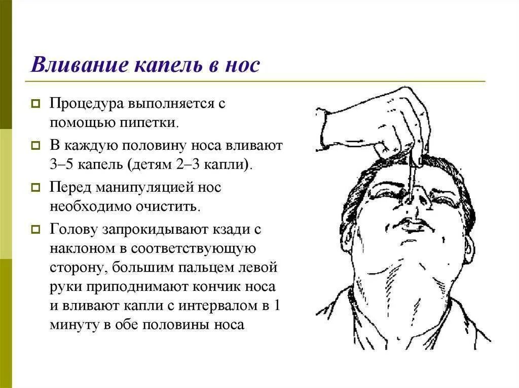 Капли в нос в глаза алгоритм. Техника введения капель в нос ребенку. Введение капель в нос алгоритм. Закапывание капель в нос детям алгоритм. Алгоритм введения капель в нос глаза.