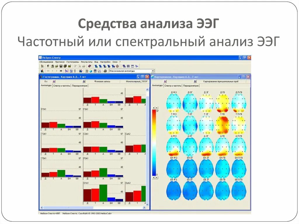 Средства анализа времени. Спектральный анализ ЭЭГ. Анализ электроэнцефалограммы. Средства анализа ЭЭГ. Спектр мощности ЭЭГ.