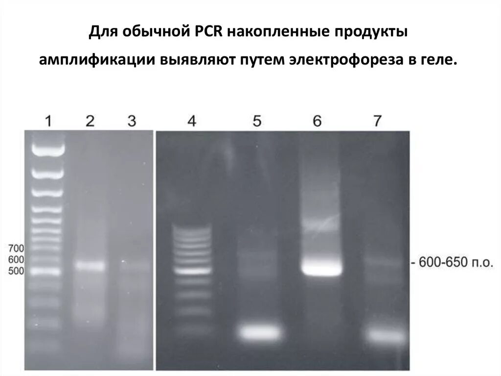 Метод детекции пцр. Электрофореграмма результатов пцр. детекция результатов пцр с помощью электрофореза. пцр электрофорез в агарозном геле. детекция гель электрофорезом.