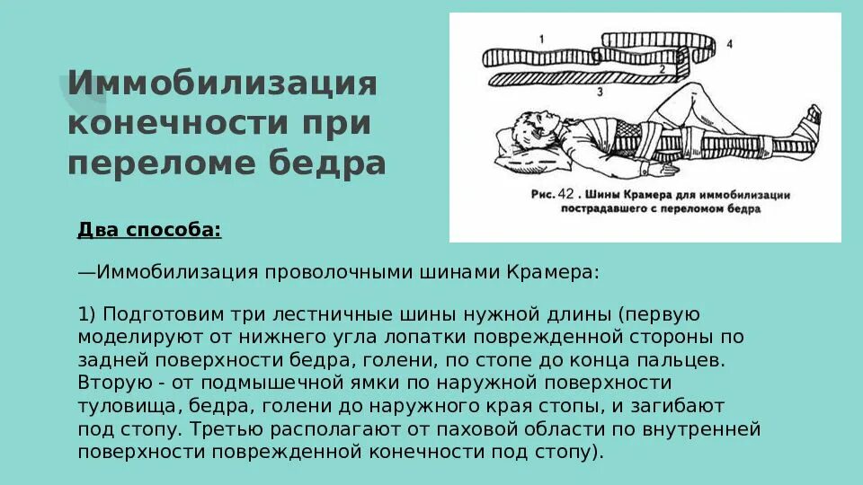 Иммобилизация костей голени шиной Крамера. Перелом бедра иммобилизация шинами Крамера. Иммобилизация при переломе шейки бедра шиной Крамера. Иммобилизация конечности при переломе бедра.