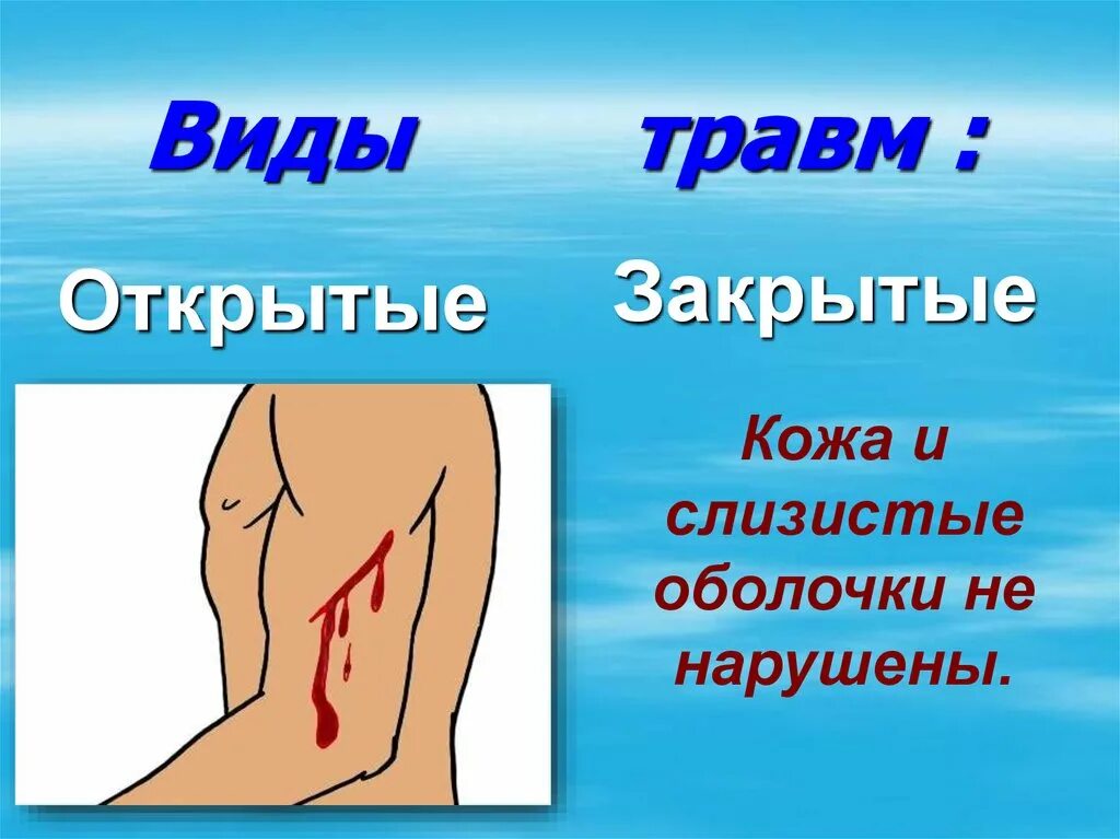 Закрытые и открытые виды. Открытые и закрытые травмы. виды травм.