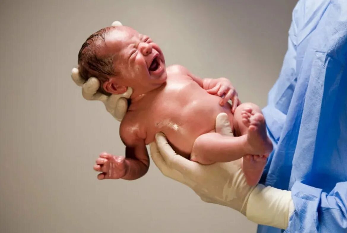 Ребенок мальчик родится. Младенец только родился.