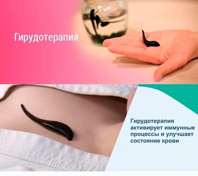 Курсы гирудотерапии. Курсы гирудотерапии