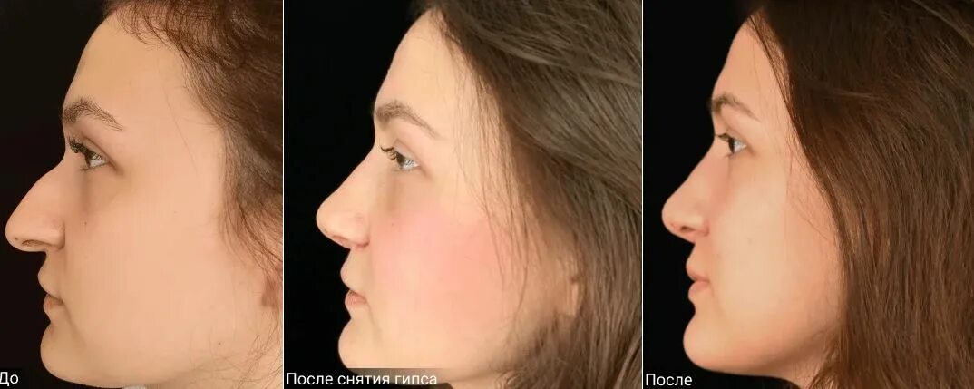 Как уменьшить нос с помощью макияжа: коррекция формы