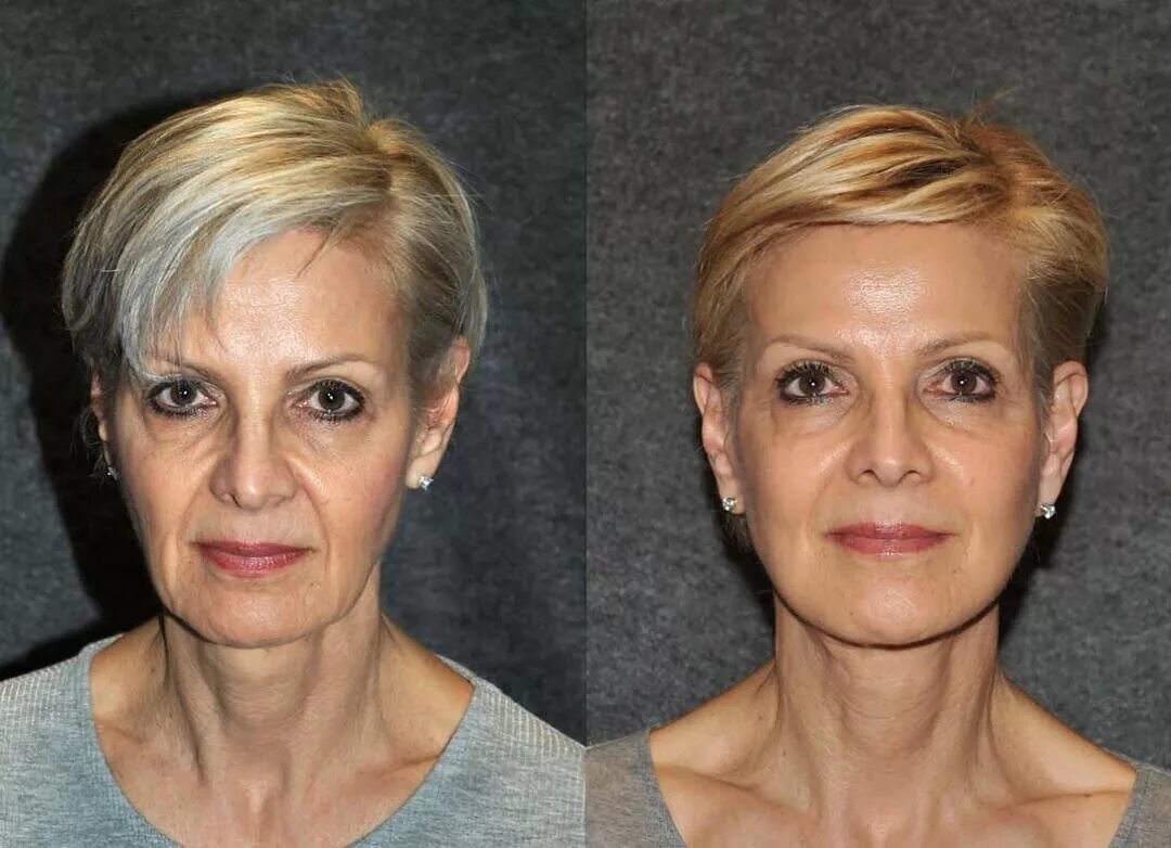 Красивая женщина 52 года. Женщина 52 года. Женщина 54 года. Лифтинг макияж до и после. Лицо в 53 года.