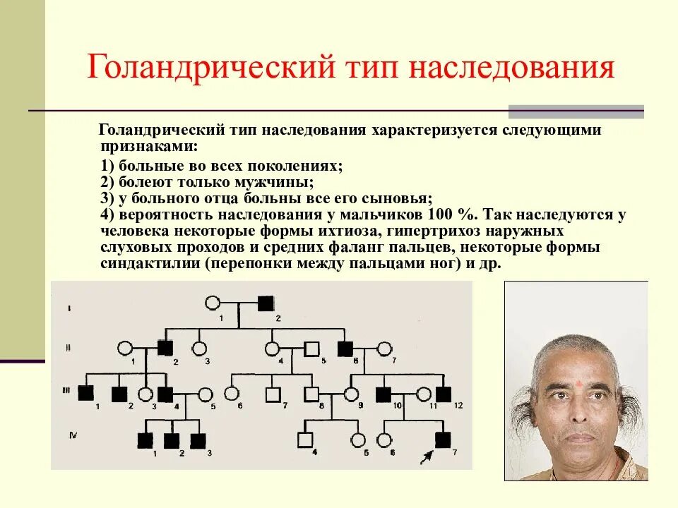 Y-cцепленный (голандрический) Тип наследования. Голандрическое наследование признаков. Голандрический Тип наследования схема наследования. Голандрический Тип наследования заболевания