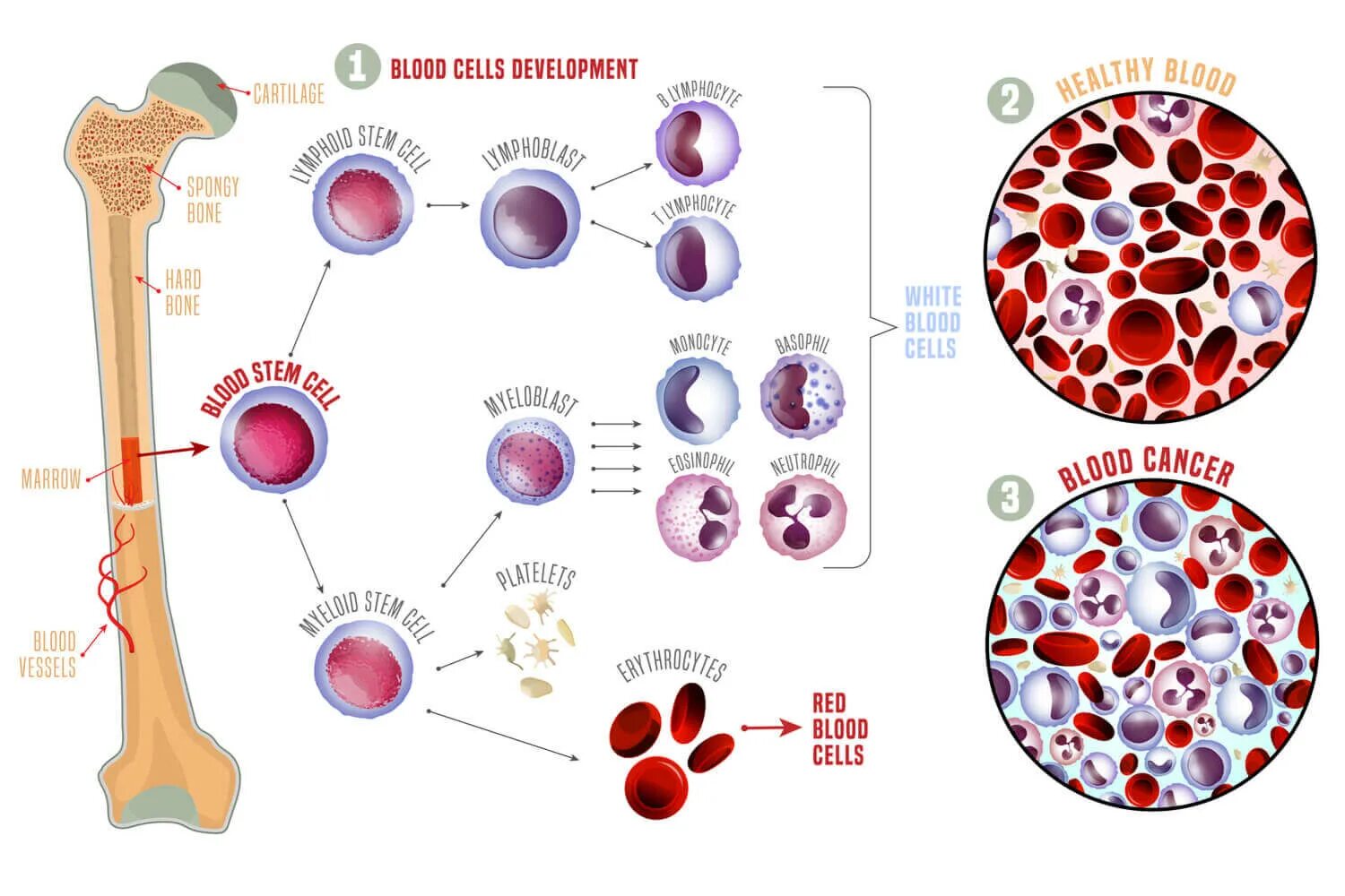 Место разрушения клеток крови. Клетки крови в микроскопе. Лейкоциты в крови под микроскопом. Клетки крови под микроскопом. Клетки крови эритроциты и лимфоциты.