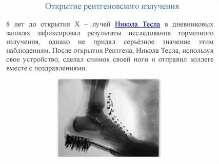 Рентгеновские лучи научное открытие