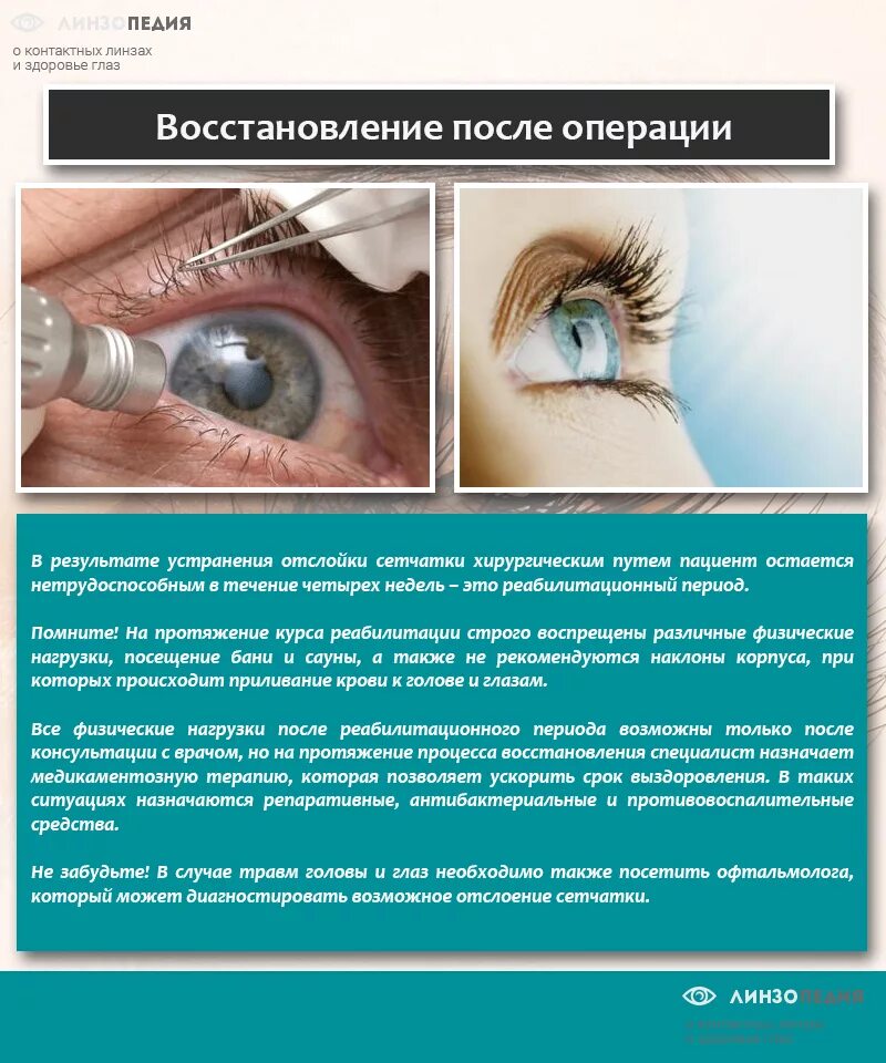 Можно пить после операции на глаза. Восстановление после операции на глаза. Отслоение сетчатки глаза операция. Отслойка сетчатки операция. Операция при отслоении сетчатки.