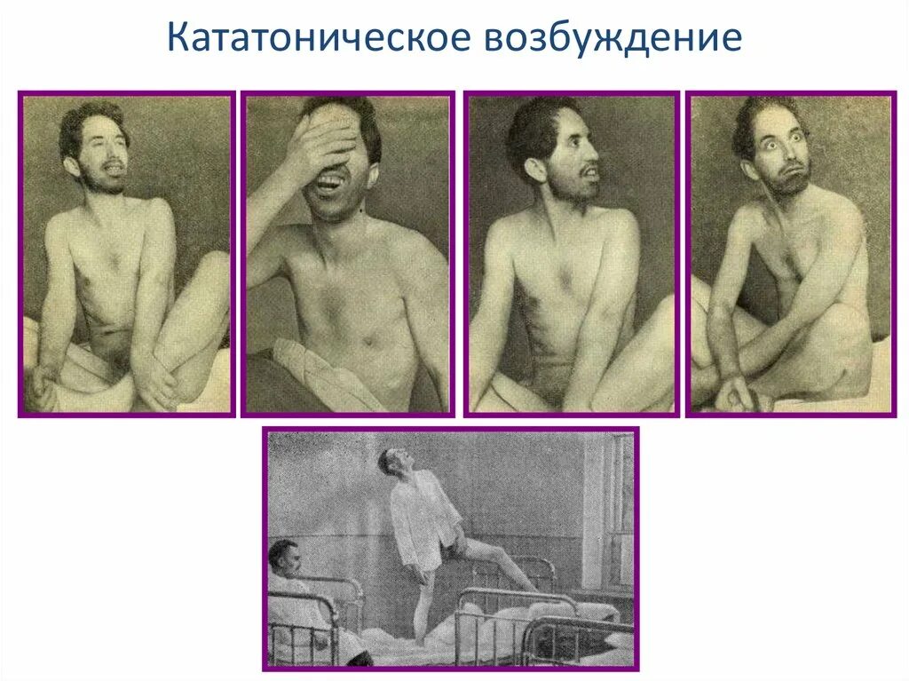 Испытания на сиротах, мор индейцев и смерть Петра II: история натуральной оспы