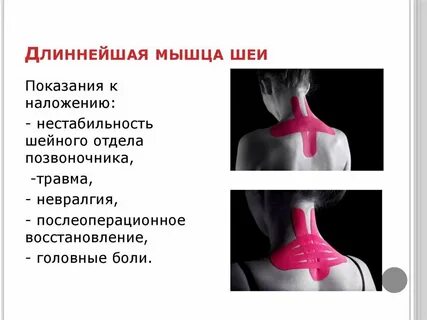 Отекают мышцы шеи