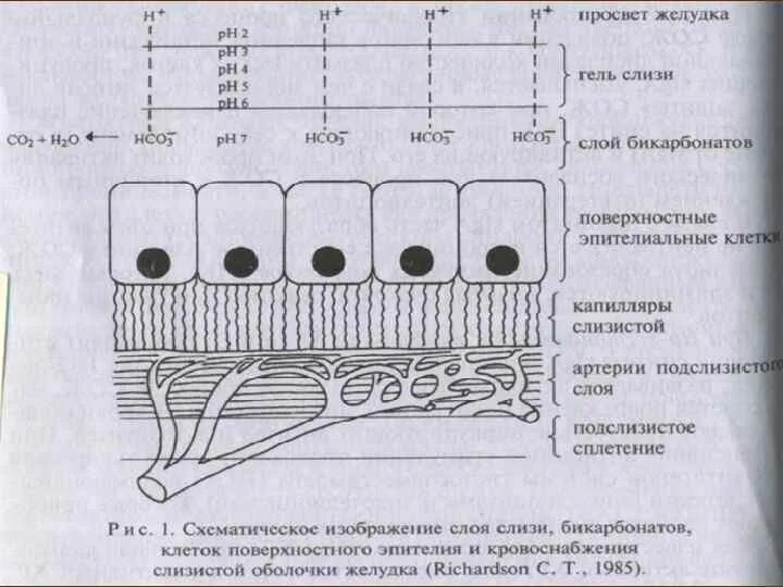 Слизисто бикарбонатный барьер. Функция слизи в желудке. Лечение дуодено-гастрального рефлюкса схема. Дуодено гастрит рефлюкс. В просвете желудка слизь.
