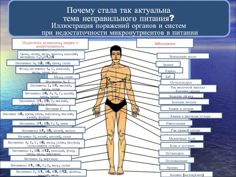 Сводит ноги чего не хватает в организме. Нехватка витаминов в организме. дефициты витаминов и микроэлементов. дефицит цинка в организме человека. цинк+селен влияние на организм.