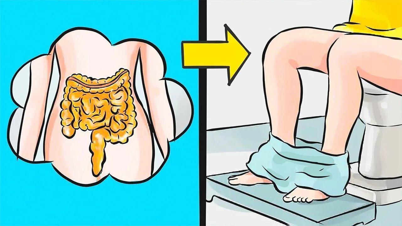 Почему плохо хожу в туалет. Понос рисунок. Что если не ходить в туалет по большому.