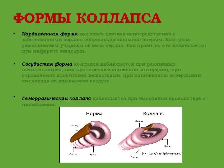 Коллапс ПМП. Стадии коллапса. Коллапс первая помощь. Механизм коллапса.