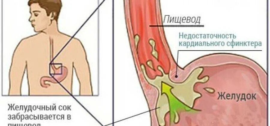 Не работает желудок симптомы