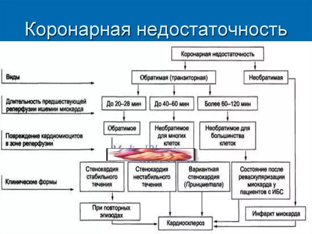 Клинические проявления коронарной недостаточности. Причины развития острой коронарной недостаточности. Последствия коронарной недостаточности патофизиология. Формы острой коронарной недостаточности. Сердечная недостаточность последствия