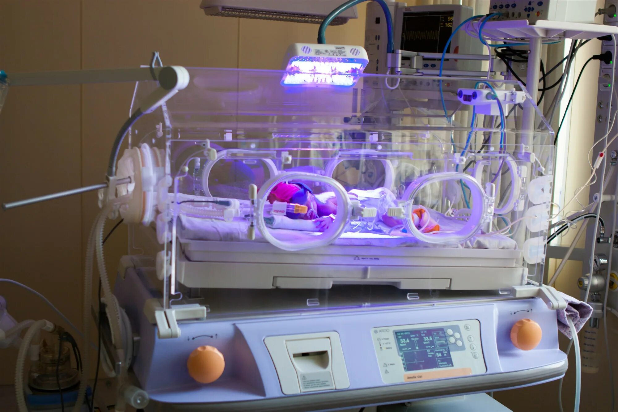 2 этап выхаживания. Инкубатор для интенсивной терапии новорожденного BABYGUARD I-1120. Кювез реанимационный для новорожденных. Кювез для новорожденных недоношенных детей. Инкубатор для новорожденных ИДН-02-«данио».