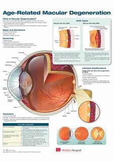 Age related macular degeneration