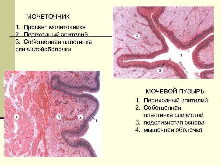 Слои переходного эпителия. Переходный эпителий мочеточника. Мочеточник переходный эпителий препарат. Слизистая мочевого пузыря гистология.
