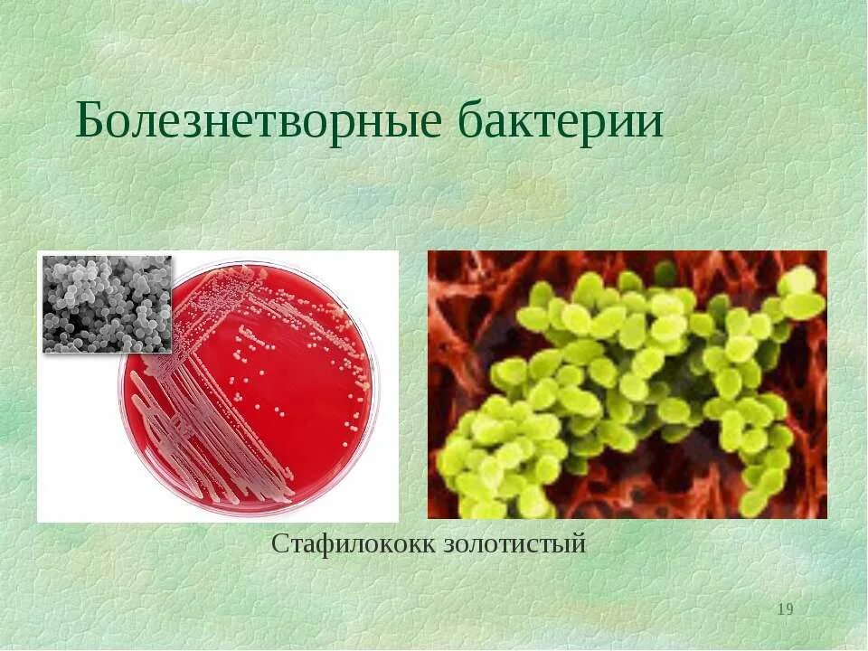 Болезнетворные бактерии биология. Болезнетворные бактерии. Болезнетворные бактерии в природе. Болезнетворные бактерии в жизни человека. Презентация на тему болезнетворные бактерии.