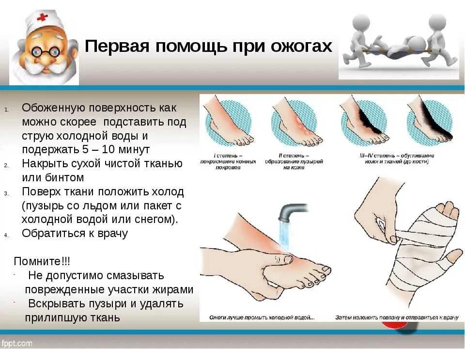 Как оказать первую помощь человеку получившему ожог. Последовательность оказания первой помощи при поверхностных ожогах. Первая доврачебная помощь при ожогах 1 и 2 степени. Оказание первой медицинской помощи при ожогах 1 степени. Оказание первой доврачебной мед помощи при ожогах.