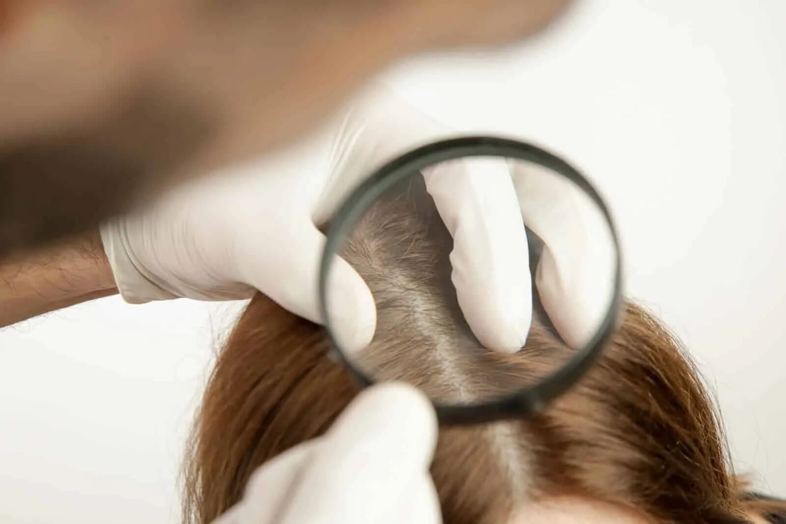 Healthy scalp
