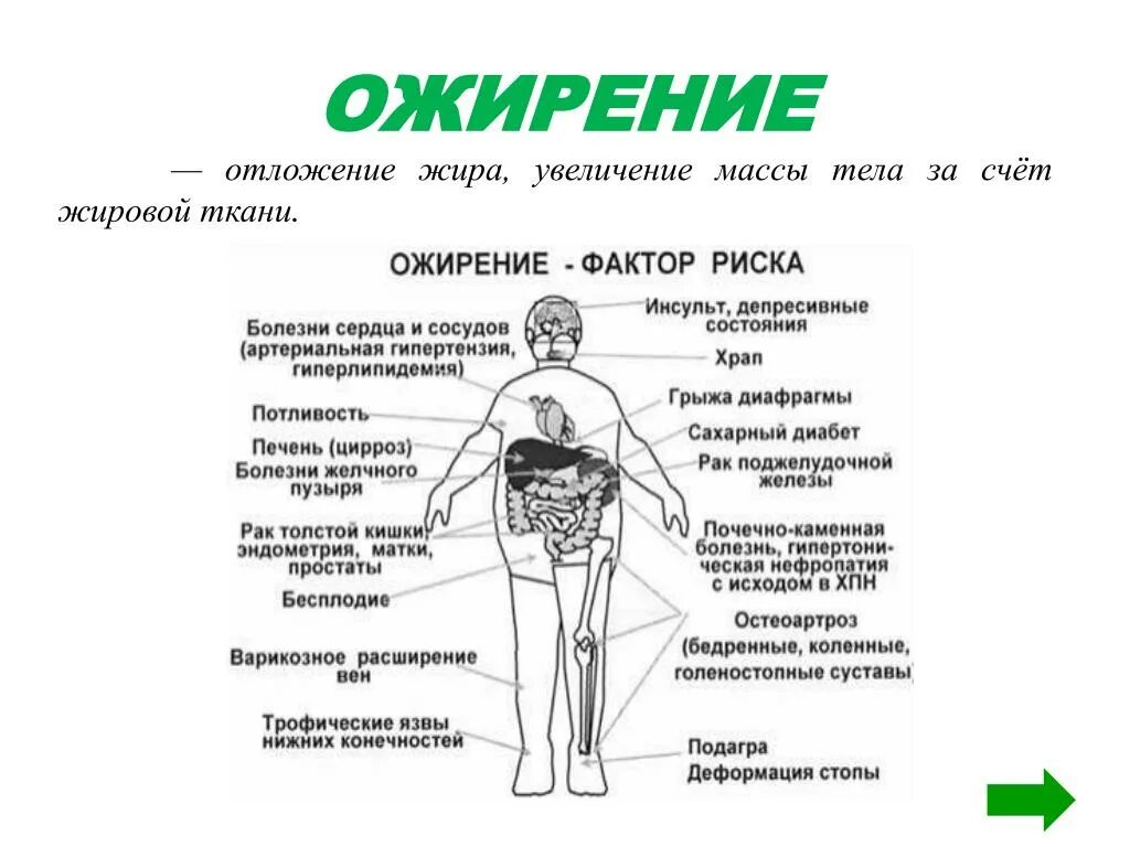 Заболевания при ожирении. Болезни избыточного веса. Ожирение профилактика ожирения. Заболевания при избыточной массе тела.