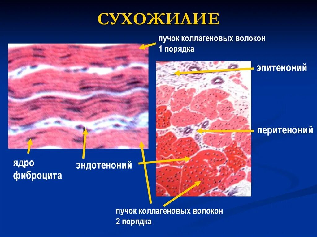 Эластическая связка