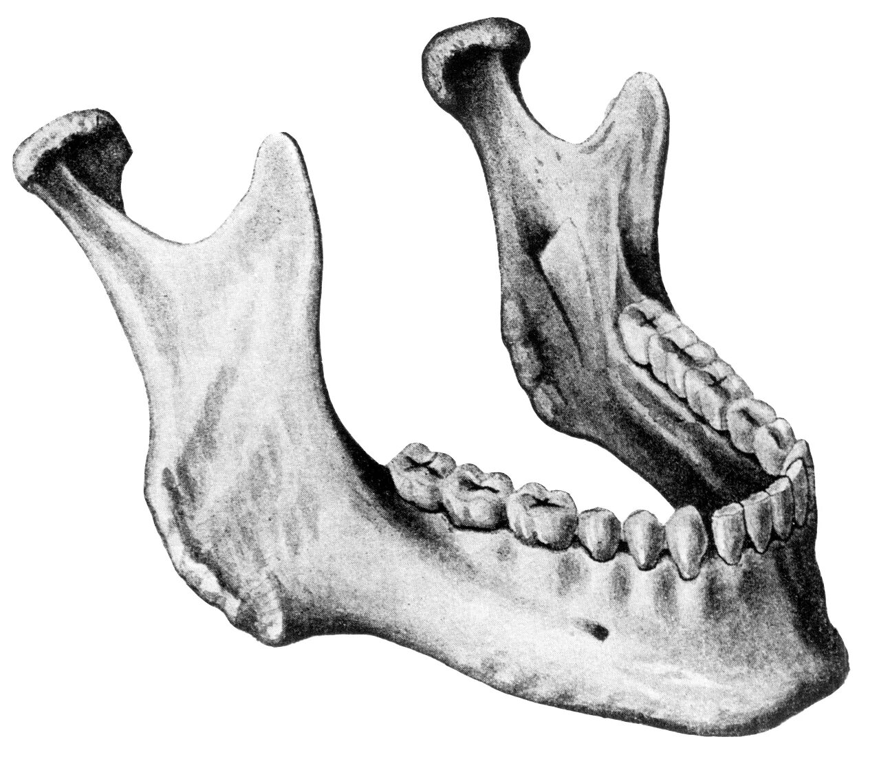 Строение кости нижней челюсти. Анатомия нижней челюсти человека кости. Анатомия нижней челюстной кости. Венечный отросток нижней челюсти.