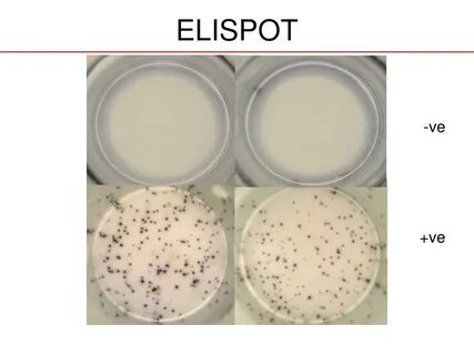 T spot тест на туберкулез