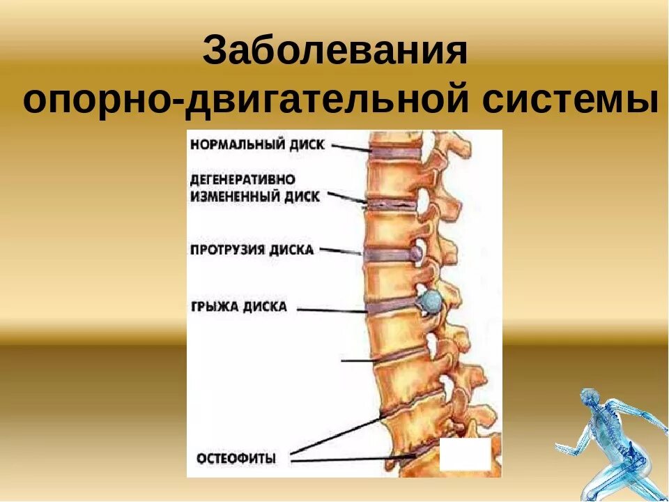 Заболевание опорно двигательный аппарат человека. Заболевания опорно-двигательной системы. Нарушение опорно двигательной системы. Профилактика заболеваний опорно-двигательного аппарата. Нарушение апорнодвигательной системы.