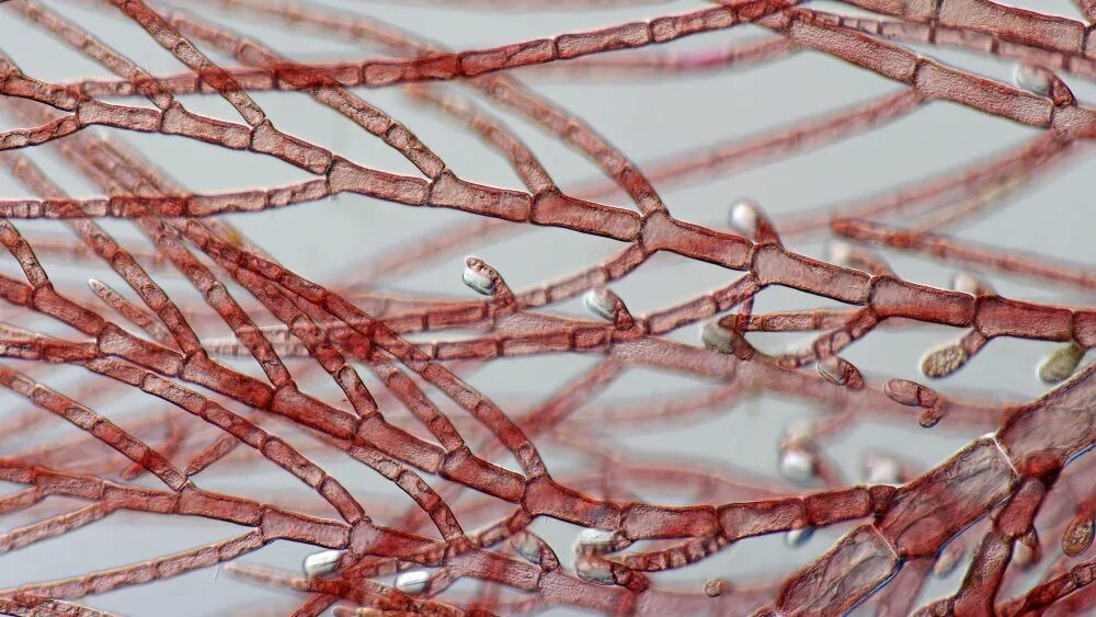 Красные водоросли клетки. Десмококкус водоросль. Церамиум водоросль. Trichodesmium Erythraeum водоросли. Бангия водоросль.